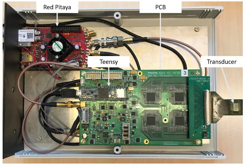 3D_Ultrasound_Robotic_System-Article_pic-1