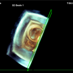 3D_Ultrasound_Robotic_System-Article_pic-3-150x150