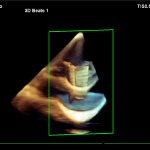 Figure 4: 3D-scan of phantom object 1