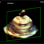 Figure 5: 3D-scan of phantom object 2