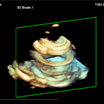 Figure 6: 3D-scan of phantom object 2